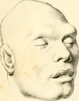 Picture 22 of 27 from Grundzüge der Phrenologie; oder, Anleitung zum Studium dieser Wissenschaft, mit Berücksichtigung der neueren Forschungen auf dem Gebiete der Physiologie und Psychologie (1856), leaf 632