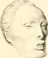 An illustration from Grundzüge der Phrenologie; oder, Anleitung zum Studium dieser Wissenschaft, mit Berücksichtigung der neueren Forschungen auf dem Gebiete der Physiologie und Psychologie (1856)