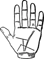 An illustration from Chiromantia. (1546)