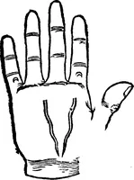 An illustration from Chiromantia. (1546)