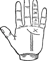 An illustration from Chiromantia. (1546)