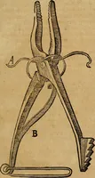 An illustration from Guilhelmi FabricI Hildani inclytae reipublicae Bernensis Helvet. medico-chirurgi ordinarii De gangraena et sphacelo, tractatus methodicus : in quo horum morborum differentiae, causae, signa, prognostica, ac denique methodica curatio continentur (1617)