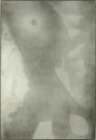 An illustration from Gunshot Roentgenograms : Acollection of Roentgenograms taken in Constantinople during the Turko-Balkan War, 1912-1913, illustrating some gunshot wounds in the Turkish Army (1916)