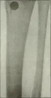 An illustration from Gunshot Roentgenograms : Acollection of Roentgenograms taken in Constantinople during the Turko-Balkan War, 1912-1913, illustrating some gunshot wounds in the Turkish Army (1916)