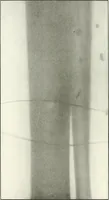 An illustration from Gunshot Roentgenograms : Acollection of Roentgenograms taken in Constantinople during the Turko-Balkan War, 1912-1913, illustrating some gunshot wounds in the Turkish Army (1916)