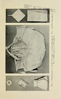 Picture 7 of 21 from A handbook of elementary sewing (1915), leaf 42