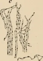 An illustration from Handbook of practical botany for the botanical laboratory and private student (1908)