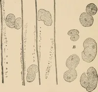 An illustration from Handbook of practical botany for the botanical laboratory and private student (1908)