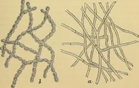An illustration from Handbuch der klinischen Mikroskopie : mit Berücksichtigung der wichtigsten chemischen Untersuchungen am Krankenbette und der Verwendung des Mikroskopes in der gerichtlichen Medicin (1883)