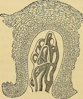 An illustration from Handbuch der klinischen Mikroskopie : mit Berücksichtigung der wichtigsten chemischen Untersuchungen am Krankenbette und der Verwendung des Mikroskopes in der gerichtlichen Medicin (1883)