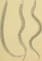 An illustration from Handbuch der klinischen Mikroskopie : mit Berücksichtigung der wichtigsten chemischen Untersuchungen am Krankenbette und der Verwendung des Mikroskopes in der gerichtlichen Medicin (1883)