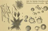 Picture 24 of 39 from Handbuch der klinischen Mikroskopie : mit Berücksichtigung der wichtigsten chemischen Untersuchungen am Krankenbette und der Verwendung des Mikroskopes in der gerichtlichen Medicin (1883), leaf 166