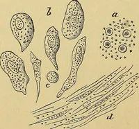 An illustration from Handbuch der klinischen Mikroskopie : mit Berücksichtigung der wichtigsten chemischen Untersuchungen am Krankenbette und der Verwendung des Mikroskopes in der gerichtlichen Medicin (1883)