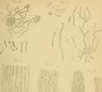 An illustration from Handbuch der klinischen Mikroskopie : mit Berücksichtigung der wichtigsten chemischen Untersuchungen am Krankenbette und der Verwendung des Mikroskopes in der gerichtlichen Medicin (1883)