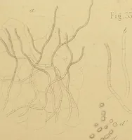 An illustration from Handbuch der klinischen Mikroskopie : mit Berücksichtigung der wichtigsten chemischen Untersuchungen am Krankenbette und der Verwendung des Mikroskopes in der gerichtlichen Medicin (1883)