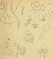 An illustration from Handbuch der klinischen Mikroskopie : mit Berücksichtigung der wichtigsten chemischen Untersuchungen am Krankenbette und der Verwendung des Mikroskopes in der gerichtlichen Medicin (1883)