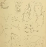 An illustration from Handbuch der klinischen Mikroskopie : mit Berücksichtigung der wichtigsten chemischen Untersuchungen am Krankenbette und der Verwendung des Mikroskopes in der gerichtlichen Medicin (1883)