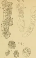 An illustration from Handbuch der klinischen Mikroskopie : mit Berücksichtigung der wichtigsten chemischen Untersuchungen am Krankenbette und der Verwendung des Mikroskopes in der gerichtlichen Medicin (1883)