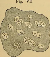 An illustration from Handbuch der klinischen Mikroskopie : mit Berücksichtigung der wichtigsten chemischen Untersuchungen am Krankenbette und der Verwendung des Mikroskopes in der gerichtlichen Medicin (1883)