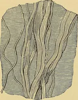 An illustration from Handbuch der klinischen Mikroskopie : mit Berücksichtigung der wichtigsten chemischen Untersuchungen am Krankenbette und der Verwendung des Mikroskopes in der gerichtlichen Medicin (1883)