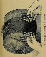 Picture 114 of 184 from Handbuch der Spitzenkunde, Technisches und Geschichtliches über die Näh-, Klöppel- und Maschinenspitzen (1894), leaf 151