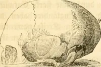 Picture 12 of 43 from Handbuch der Phrenologie (1845), leaf 101