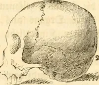 Picture 13 of 43 from Handbuch der Phrenologie (1845), leaf 101