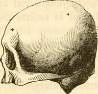 Picture 15 of 43 from Handbuch der Phrenologie (1845), leaf 107