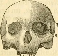 Picture 18 of 43 from Handbuch der Phrenologie (1845), leaf 121