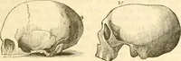 Picture 24 of 43 from Handbuch der Phrenologie (1845), leaf 155