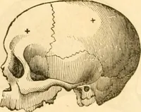 Picture 28 of 43 from Handbuch der Phrenologie (1845), leaf 160