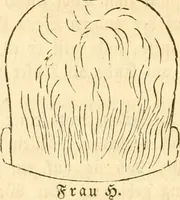 Picture 31 of 43 from Handbuch der Phrenologie (1845), leaf 172