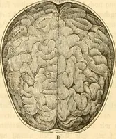 Picture 5 of 43 from Handbuch der Phrenologie (1845), leaf 34