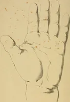 An illustration from The hand phrenologically considered: being a glimpse at the relation of the mind with the organisation of the body (1748)