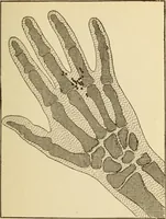An illustration from Henry and Hora's modern electricity; a practical working encyclopedia (1915)