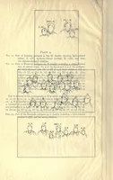 Picture 8 of 8 from Heredity of skin color in negro-white crosses. With appendix, being abridgement of field-notes, chiefly of Florence H. Danielson (1913), leaf 136