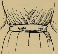Picture 100 of 182 from The heritage of dress; being notes on the history and evolution of clothes (1912), leaf 112