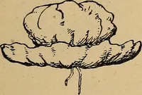 Picture 60 of 182 from The heritage of dress; being notes on the history and evolution of clothes (1912), leaf 77