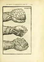 Picture 15 of 27 from Hieronymi Mercurialis Foroliviensis De arte gymnastica libri sex : in quibus exercitationum omnium vetustarum genera, loca, modi, facultates, & quidquid denique ad corporis humani exercitationes pertinet diligenter explicatur (1672), leaf 177