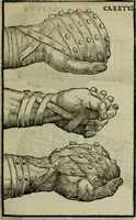 Picture 17 of 29 from Hieronymi Mercvrialis De arte gymnastica libri sex : in quibus exercitationum omnium vetustarum genera, loca, modi, facultates, & quidquid deniq. ad corporis humani exercitationes pertinet, diligenter explicatur .. (1573), leaf 132