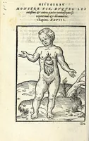 An illustration from Histoires prodigieuses extraictes de plusieurs fameux autheurs, grecz & latins, sacrez & prophanes (1561)