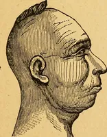 An illustration from How to read character : a new illustrated hand-book of phrenology and physiognomy, for students and examiners : with a descriptive chart (1890)