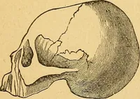 An illustration from How to read character : a new illustrated hand-book of phrenology and physiognomy, for students and examiners : with a descriptive chart (1890)