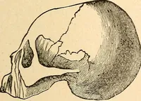 Picture 73 of 148 from How to read character : a new illustrated hand-book of phrenology and physiognomy, for students and examiners; with a descriptive chart (1891), leaf 78