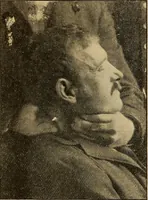 Picture 94 of 104 from How to read the human head and face (1903), leaf 101
