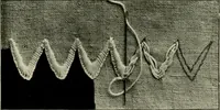An illustration from How to work embroidery stitches; a practical method with 69 illustrations (1909)