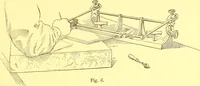 An illustration from How to work it; a manual for the use of the Ben Day rapid shading mediums and its registry attachments (1913)
