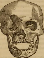 An illustration from Human science, or, Phrenology : its principles, proofs, faculties, organs, temperaments, combinations, conditions, teachings, philosophies, etc., etc. : as applied to health, its values, laws, functions, organs, means, preservation, restoration, etc. : mental philosophy, human and self improvement, civilization, home, country, commerce, rights, duties, ethics, etc. : God, His existence, attributes, laws, worship, natural theology, etc. : immortality, its evidences, conditions, relations to time, rewards, punishments, sin, faith, prayer, etc. : intellect, memory, juvenile and self education, literature, mental discipline, the senses, sciences, arts, avocations, a perfect life, etc., etc., etc. (1873)