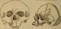 An illustration from Human science, or, Phrenology : its principles, proofs, faculties, organs, temperaments, combinations, conditions, teachings, philosophies, etc., etc. : as applied to health, its values, laws, functions, organs, means, preservation, restoration, etc. : mental philosophy, human and self improvement, civilization, home, country, commerce, rights, duties, ethics, etc. : God, His existence, attributes, laws, worship, natural theology, etc. : immortality, its evidences, conditions, relations to time, rewards, punishments, sin, faith, prayer, etc. : intellect, memory, juvenile and self education, literature, mental discipline, the senses, sciences, arts, avocations, a perfect life, etc., etc., etc. (1873)