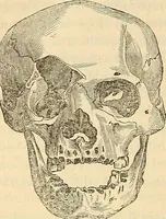 An illustration from Human science or phrenology. Its principles, proofs, faculties, organs, temperaments, combinations, conditions, teachings, philosophies, etc., etc. as applied to health. Its value, laws, functions, organs, means, preservation, restoration, etc. Mental philosophy, human and self improvement, civilization, home country, commerce rights, duties, ethics, etc. God, His existence, attributes, laws, worship, natural theology, etc. Immortality, its evidences, conditions, relations to time, rewards, punishments, sin, faith, prayer, etc. Intellect, memory, juvenile and self education, literature, mental discipline, the senses, sciences, arts, avocations, a perfect life, etc., etc (1880)